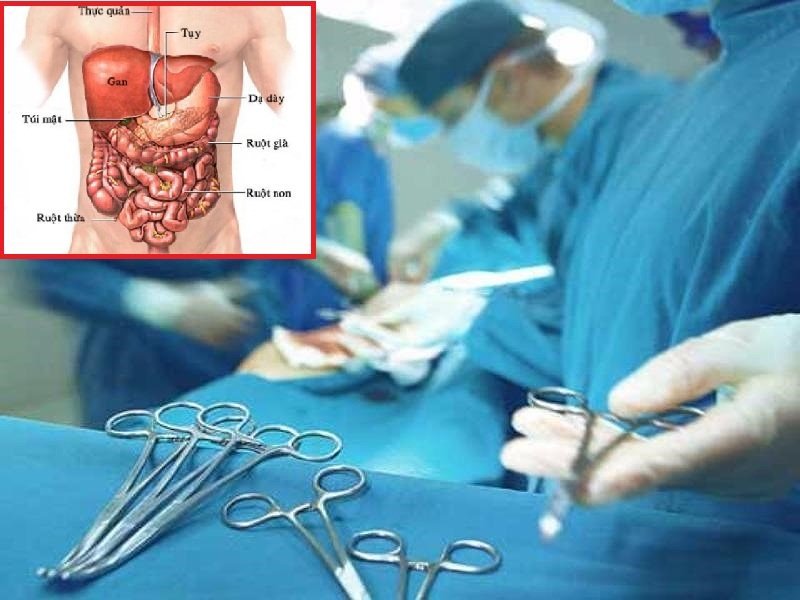 Lập kế hoạch chăm sóc bệnh nhân sau mổ để tránh biến chứng