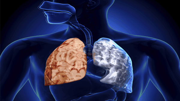 kỹ thuật chăm sóc bệnh nhân copd