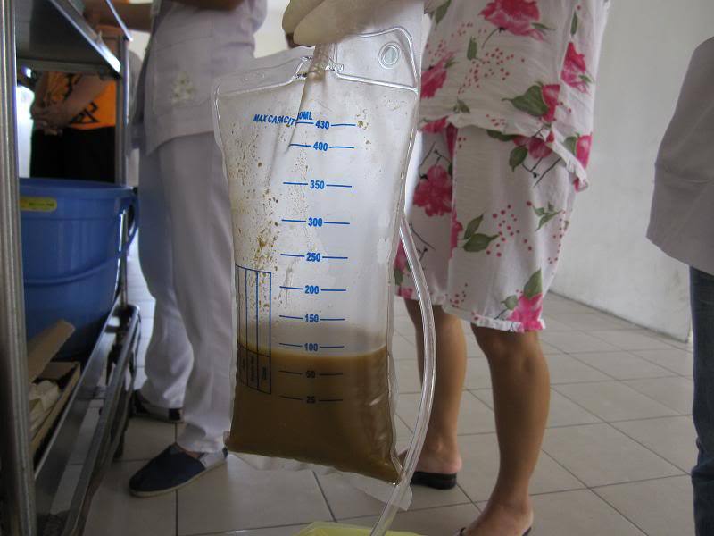 Cần biết đầy đủ kỹ thuật đặt sonde dạ dày