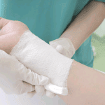 Hướng dẫn cụ thể quy trình thay băng rửa vết thương