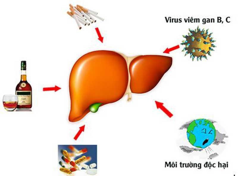 Số lượng người mắc bệnh viêm gan B là khá lớn